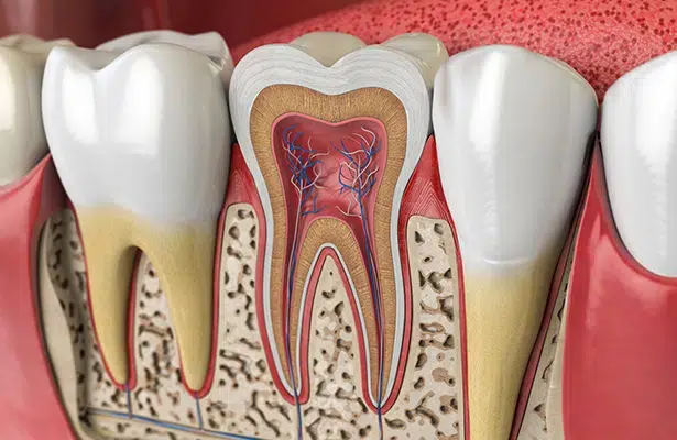 Root Union Joint Root Canal Treatment Union NJ | Duo Dental Group
